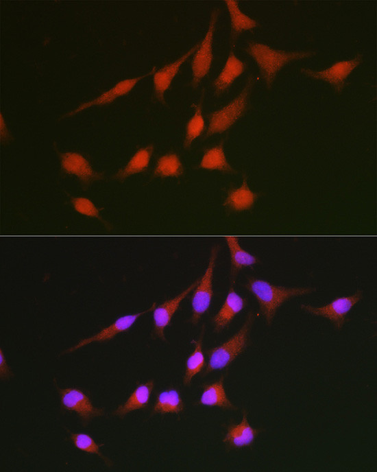 Nrf2 Antibody in Immunocytochemistry (ICC/IF)