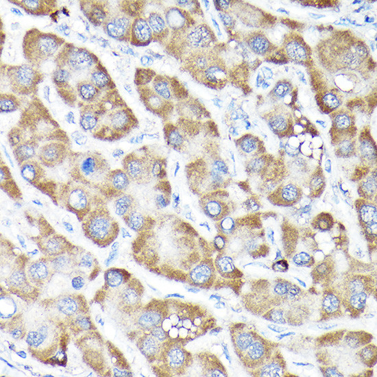 Nrf2 Antibody in Immunohistochemistry (Paraffin) (IHC (P))