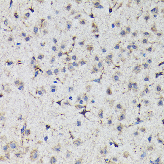 Nrf2 Antibody in Immunohistochemistry (Paraffin) (IHC (P))