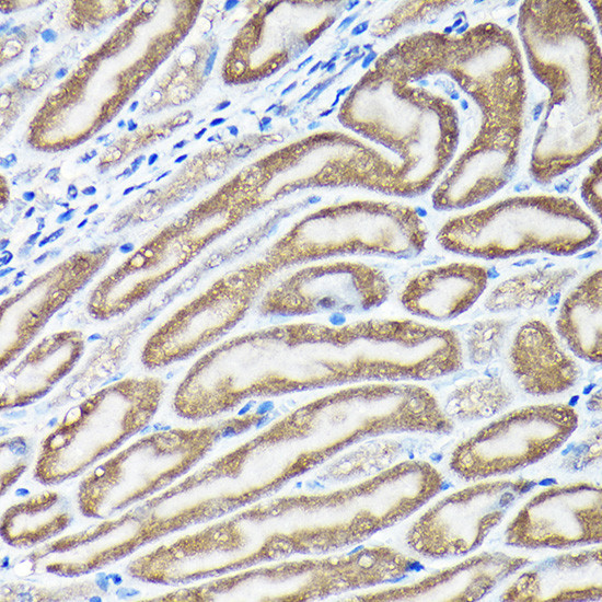 Nrf2 Antibody in Immunohistochemistry (Paraffin) (IHC (P))