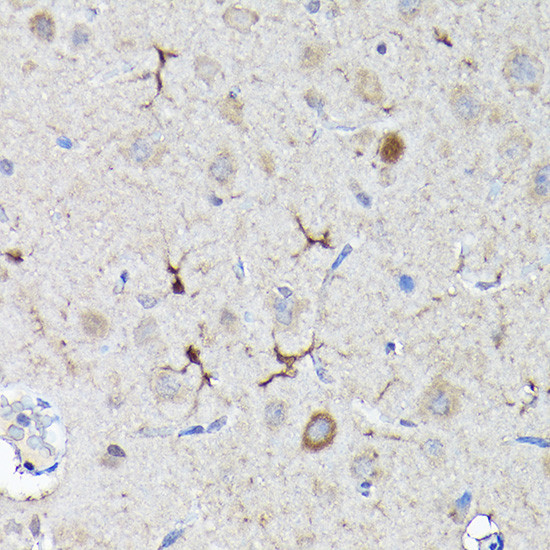 Nrf2 Antibody in Immunohistochemistry (Paraffin) (IHC (P))