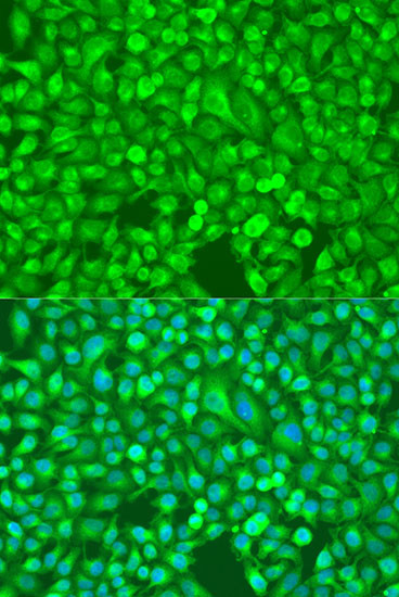 NFkB p52 Antibody in Immunocytochemistry (ICC/IF)