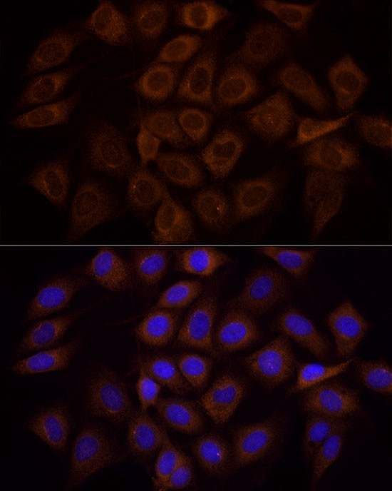 PI3K p85 alpha Antibody in Immunocytochemistry (ICC/IF)