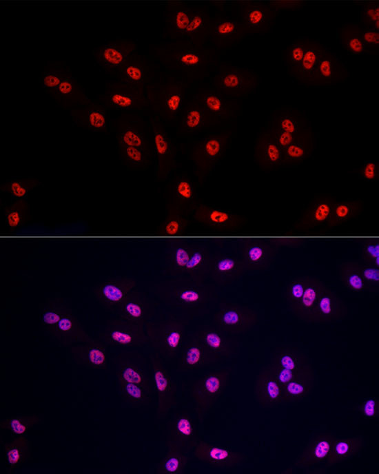 POLR2A Antibody in Immunocytochemistry (ICC/IF)