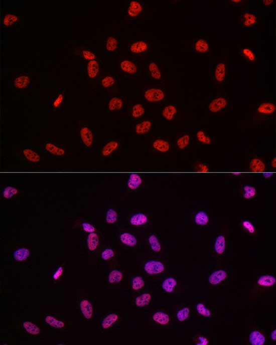 POLR2A Antibody in Immunocytochemistry (ICC/IF)