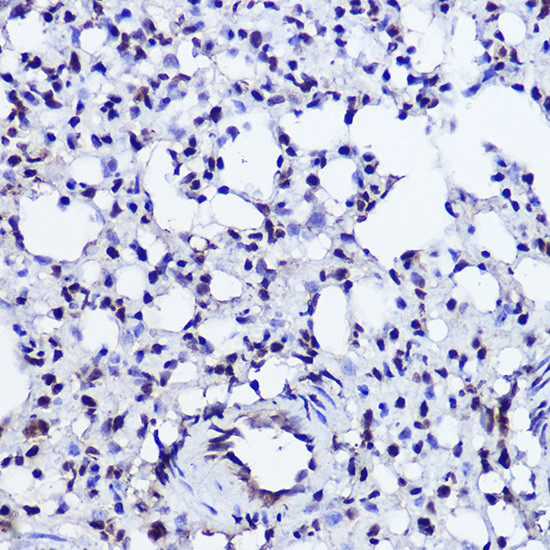 POLR2A Antibody in Immunohistochemistry (Paraffin) (IHC (P))