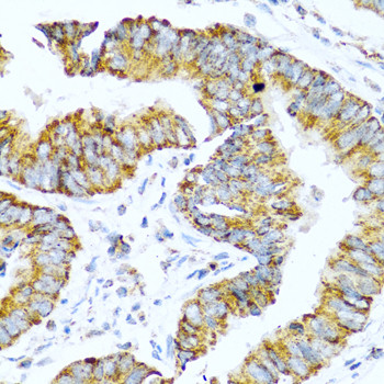 Glucagon Antibody in Immunohistochemistry (Paraffin) (IHC (P))