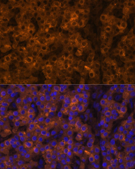 Transthyretin Antibody in Immunohistochemistry (Paraffin) (IHC (P))