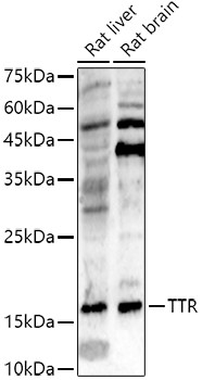 Transthyretin Antibody in Western Blot (WB)