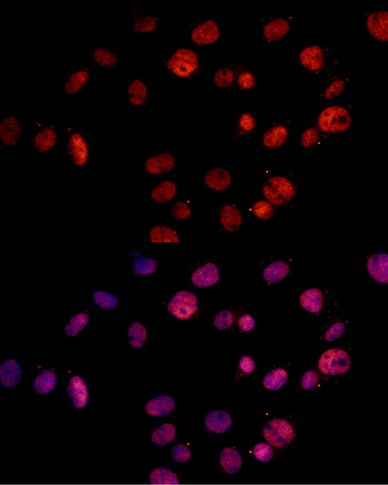 MSH2 Antibody in Immunocytochemistry (ICC/IF)