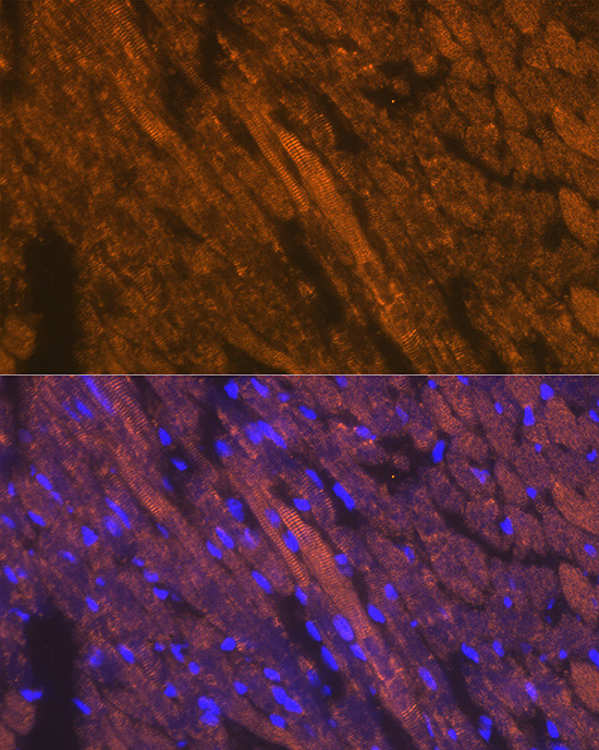 Cardiac Troponin T Antibody in Immunocytochemistry (ICC/IF)