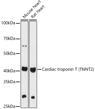 Cardiac Troponin T Antibody in Western Blot (WB)