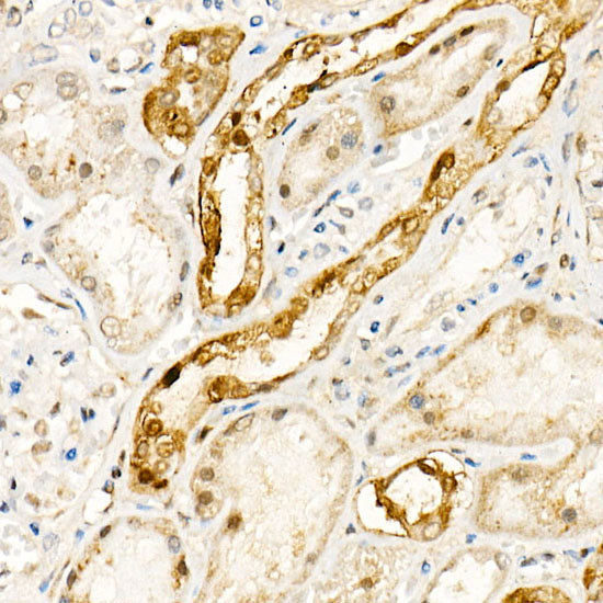 NOX4 Antibody in Immunohistochemistry (Paraffin) (IHC (P))