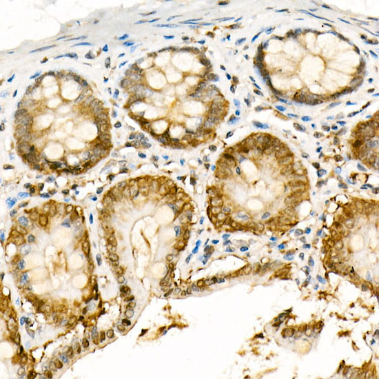 NOX4 Antibody in Immunohistochemistry (Paraffin) (IHC (P))