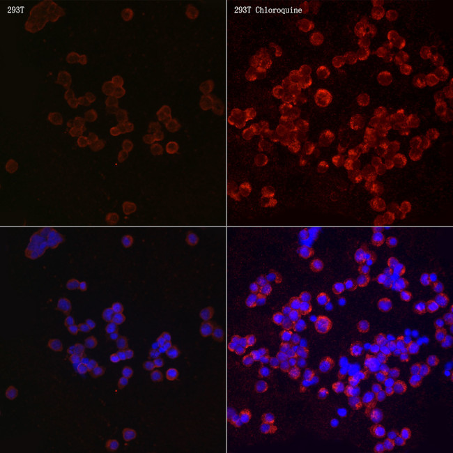 LC3B Antibody in Immunocytochemistry (ICC/IF)