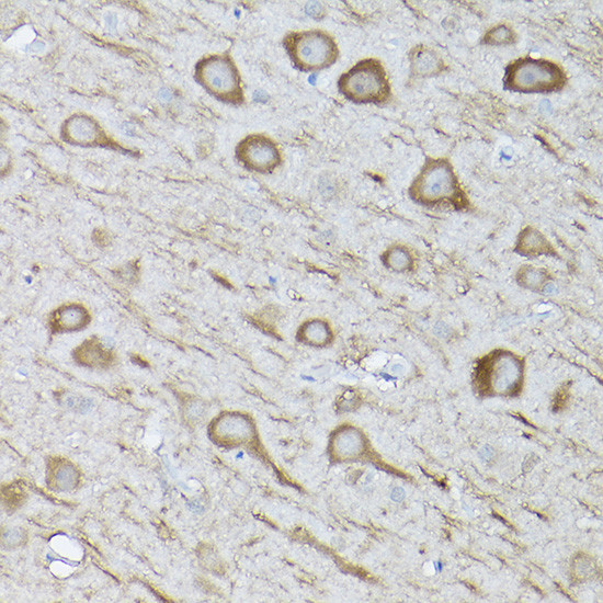 LC3B Antibody in Immunohistochemistry (Paraffin) (IHC (P))