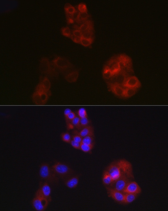 ApoA1 Antibody in Immunocytochemistry (ICC/IF)