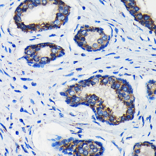 AMACR Antibody in Immunohistochemistry (Paraffin) (IHC (P))