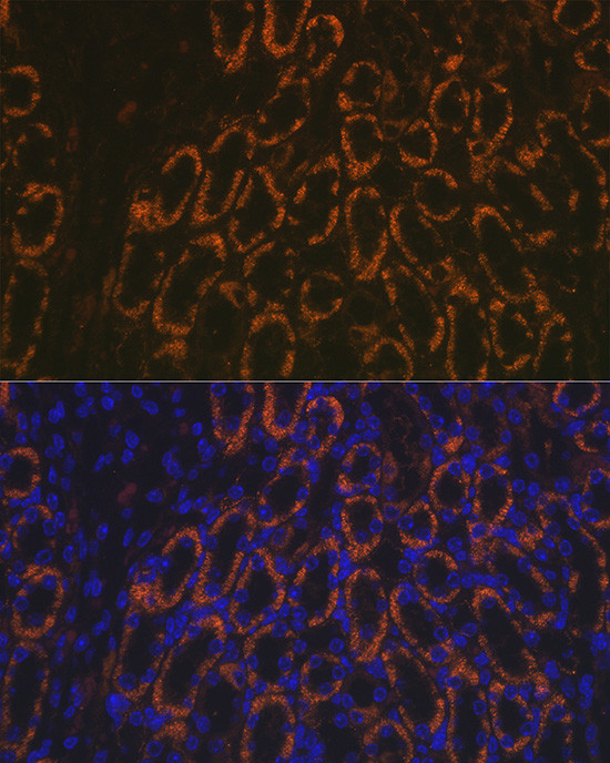 AMACR Antibody in Immunohistochemistry (Paraffin) (IHC (P))