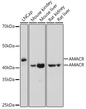 AMACR Antibody in Western Blot (WB)