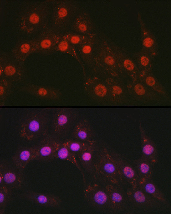 CTCF Antibody in Immunocytochemistry (ICC/IF)