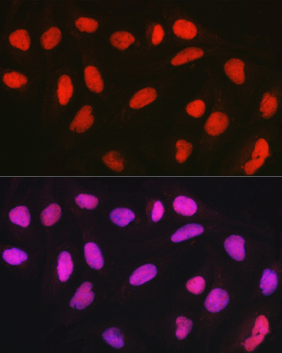 CTCF Antibody in Immunocytochemistry (ICC/IF)