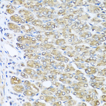 RAC2 Antibody in Immunohistochemistry (Paraffin) (IHC (P))