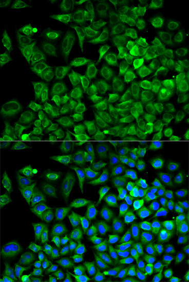 Aldolase A Antibody in Immunocytochemistry (ICC/IF)