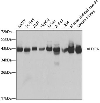 Aldolase A Antibody in Western Blot (WB)