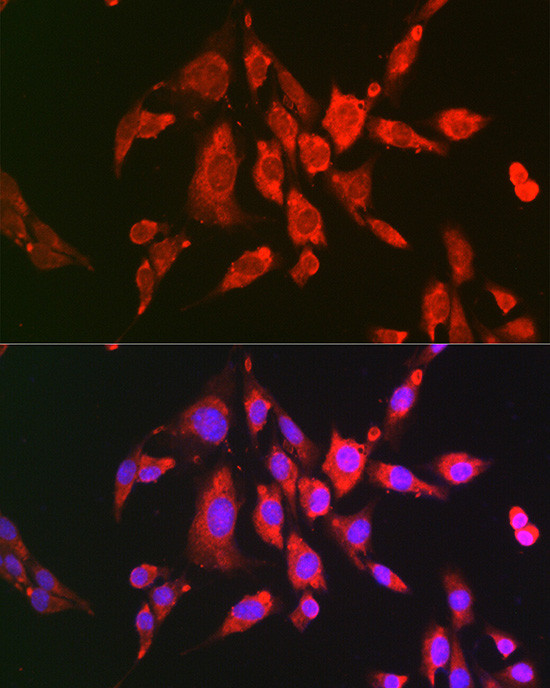 PYCARD Antibody in Immunocytochemistry (ICC/IF)