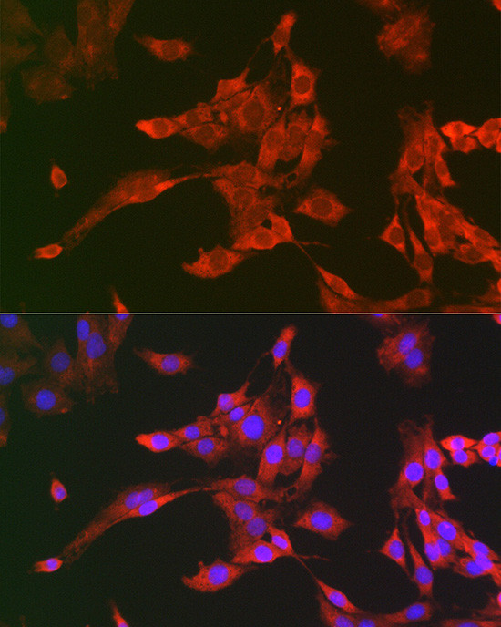 PYCARD Antibody in Immunocytochemistry (ICC/IF)