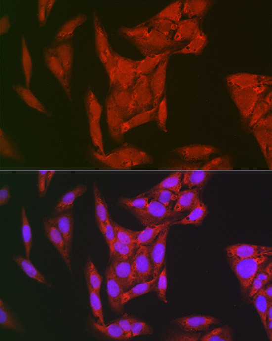 PYCARD Antibody in Immunocytochemistry (ICC/IF)