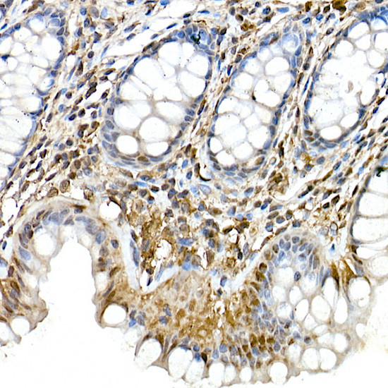 PYCARD Antibody in Immunohistochemistry (Paraffin) (IHC (P))