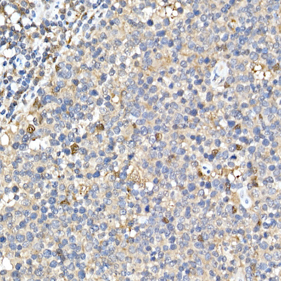 PYCARD Antibody in Immunohistochemistry (Paraffin) (IHC (P))