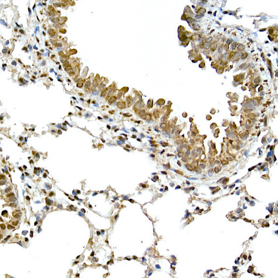 PYCARD Antibody in Immunohistochemistry (Paraffin) (IHC (P))