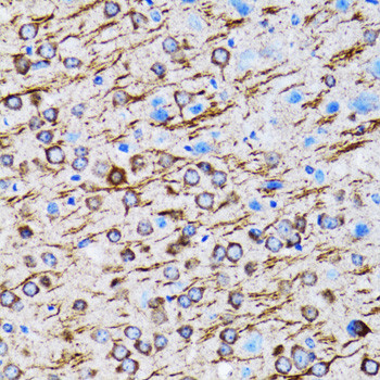 LC3A Antibody in Immunohistochemistry (Paraffin) (IHC (P))