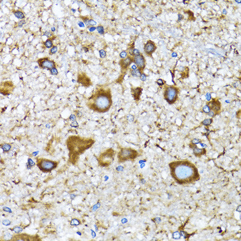 LC3A Antibody in Immunohistochemistry (Paraffin) (IHC (P))