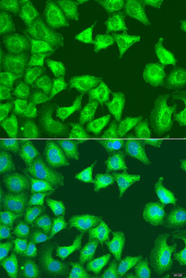 SQSTM1 Antibody in Immunocytochemistry (ICC/IF)