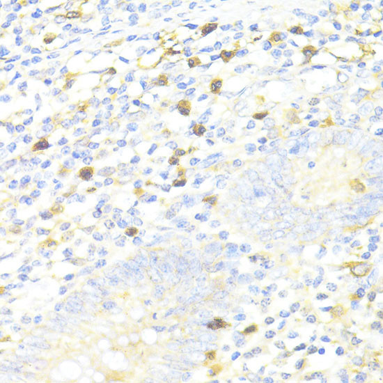 SQSTM1 Antibody in Immunohistochemistry (Paraffin) (IHC (P))