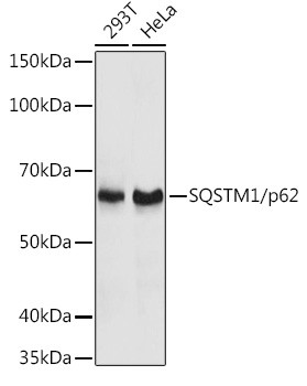 SQSTM1 Antibody in Western Blot (WB)