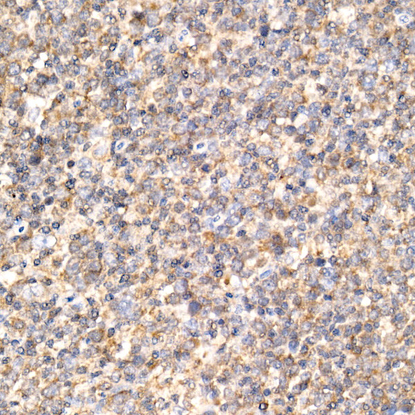 KEAP1 Antibody in Immunohistochemistry (Paraffin) (IHC (P))