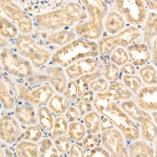 KEAP1 Antibody in Immunohistochemistry (Paraffin) (IHC (P))