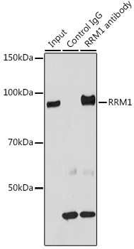 RRM1 Antibody in Immunoprecipitation (IP)