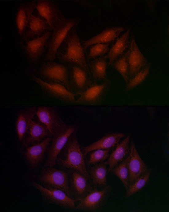 BRCA1 Antibody in Immunocytochemistry (ICC/IF)