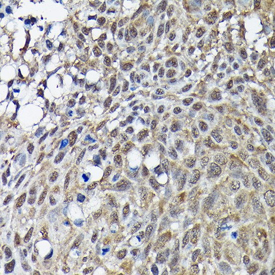 BRCA1 Antibody in Immunohistochemistry (Paraffin) (IHC (P))