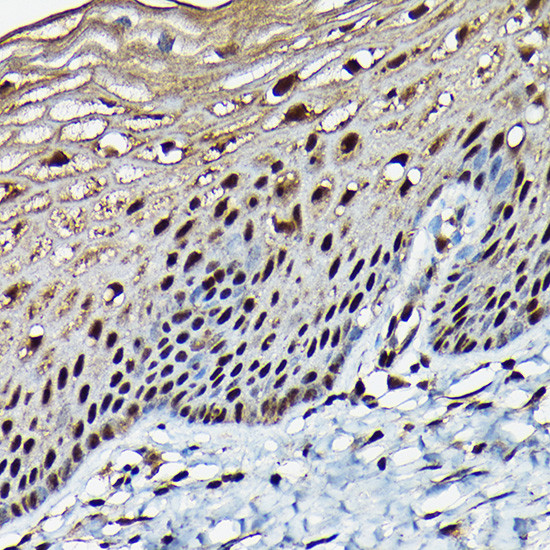 BRCA1 Antibody in Immunohistochemistry (Paraffin) (IHC (P))