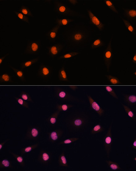 CHD4 Antibody in Immunocytochemistry (ICC/IF)