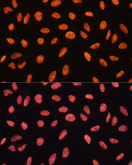 CHD4 Antibody in Immunocytochemistry (ICC/IF)