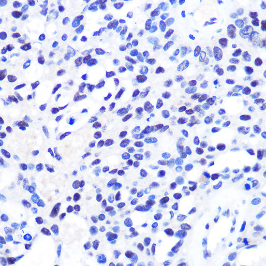 CHD4 Antibody in Immunohistochemistry (Paraffin) (IHC (P))