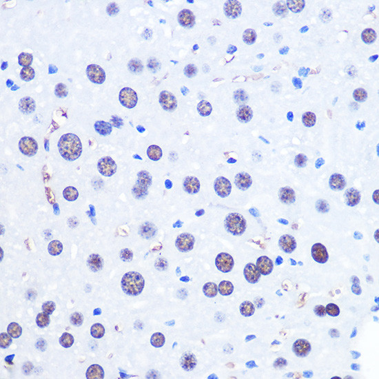 CHD4 Antibody in Immunohistochemistry (Paraffin) (IHC (P))